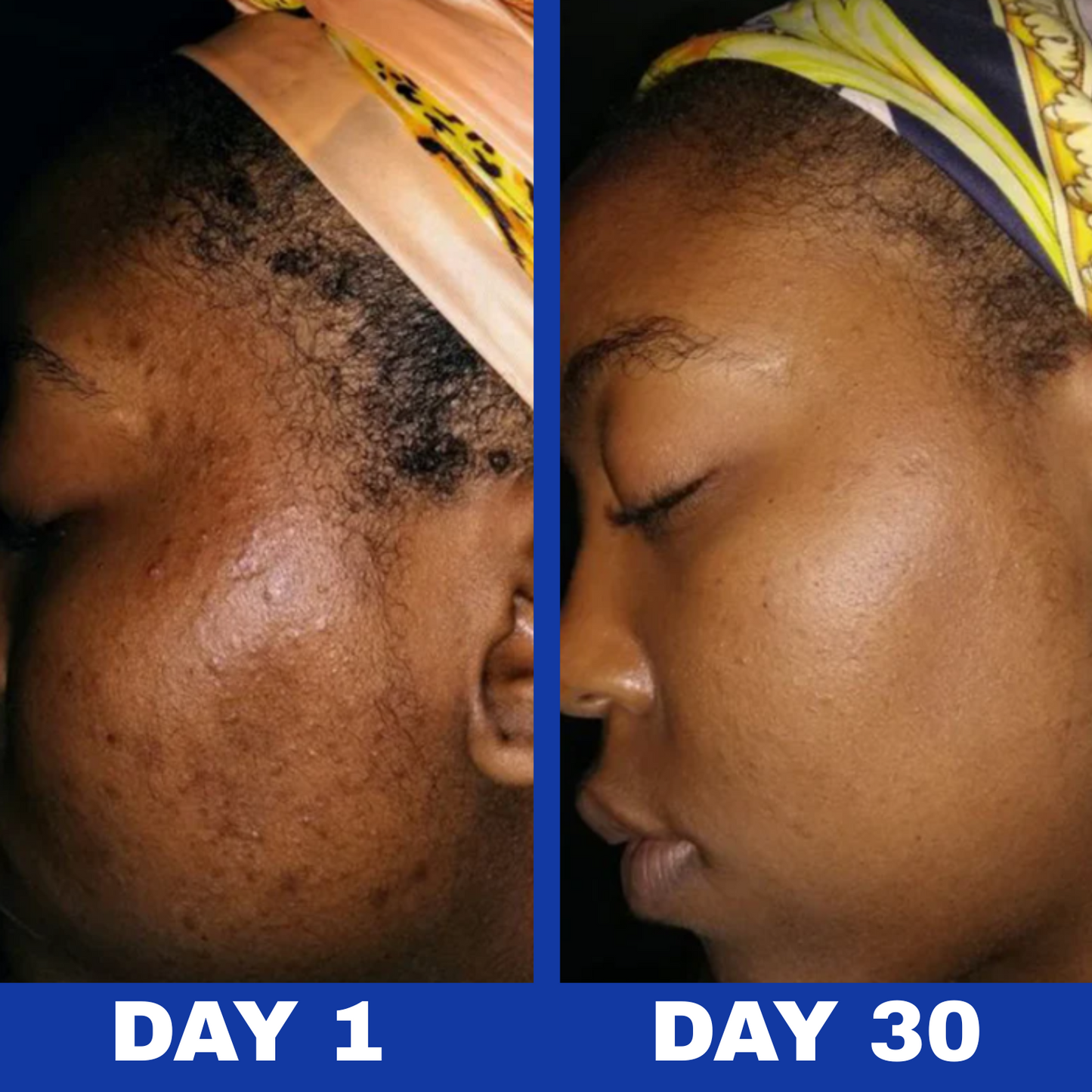 Aura™ A313 Skin Revival Cream