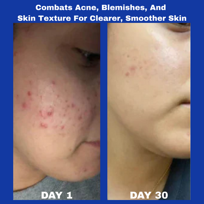 Aura™ A313 Skin Revival Cream