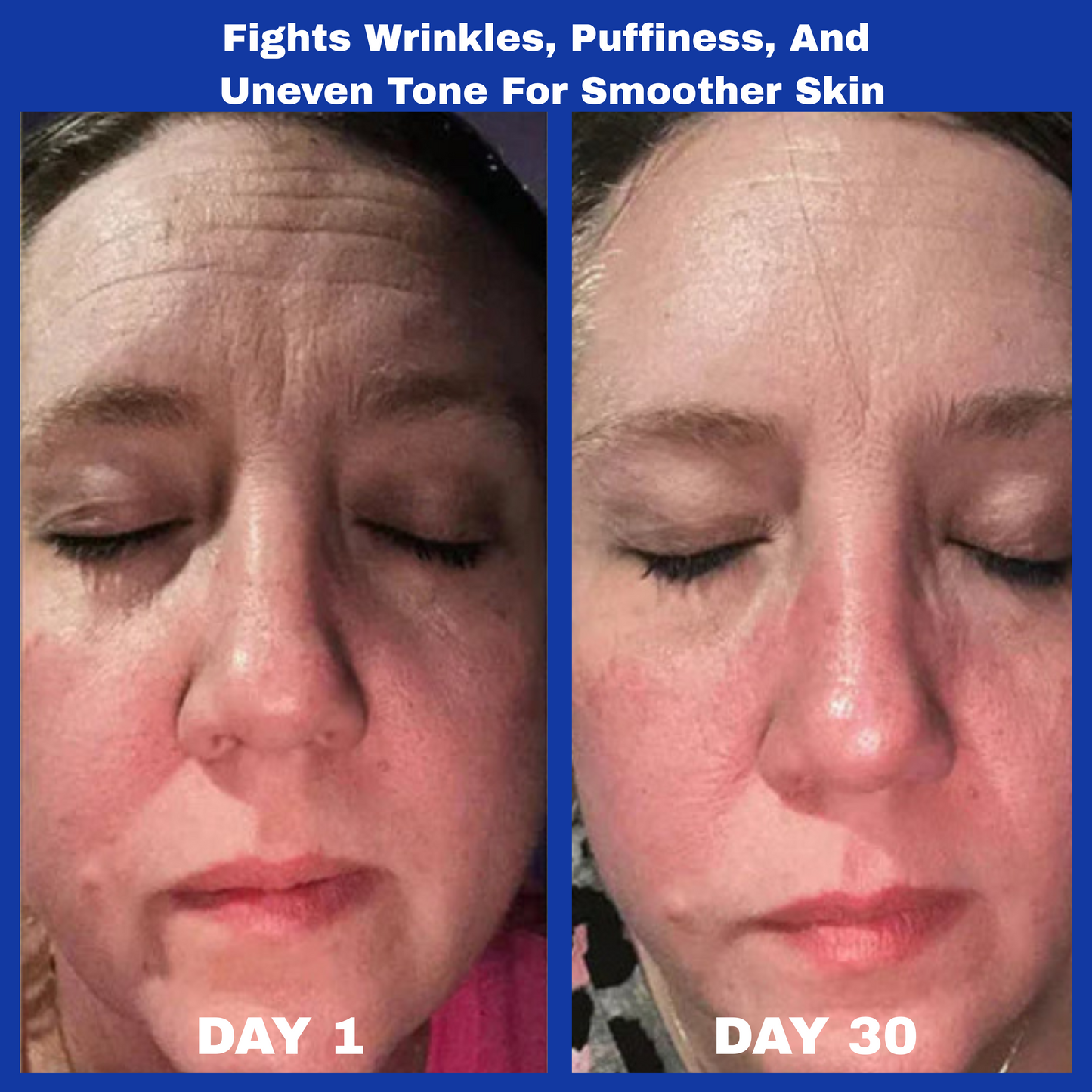 Aura™ A313 Skin Revival Cream