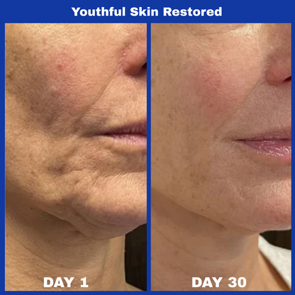 Aura™ A313 Skin Revival Cream